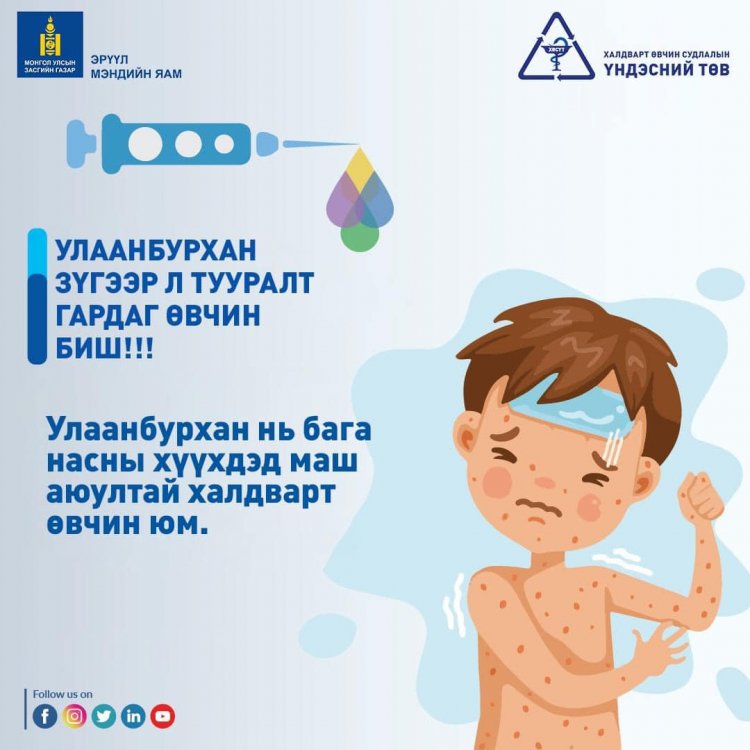 Улаанбурхан зүгээр л тууралт гардаг өвчин биш!