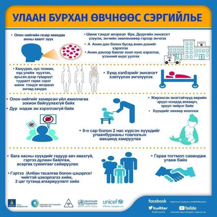 улаан бурхан өвчнөөс урьдчилан сэргийлэх
